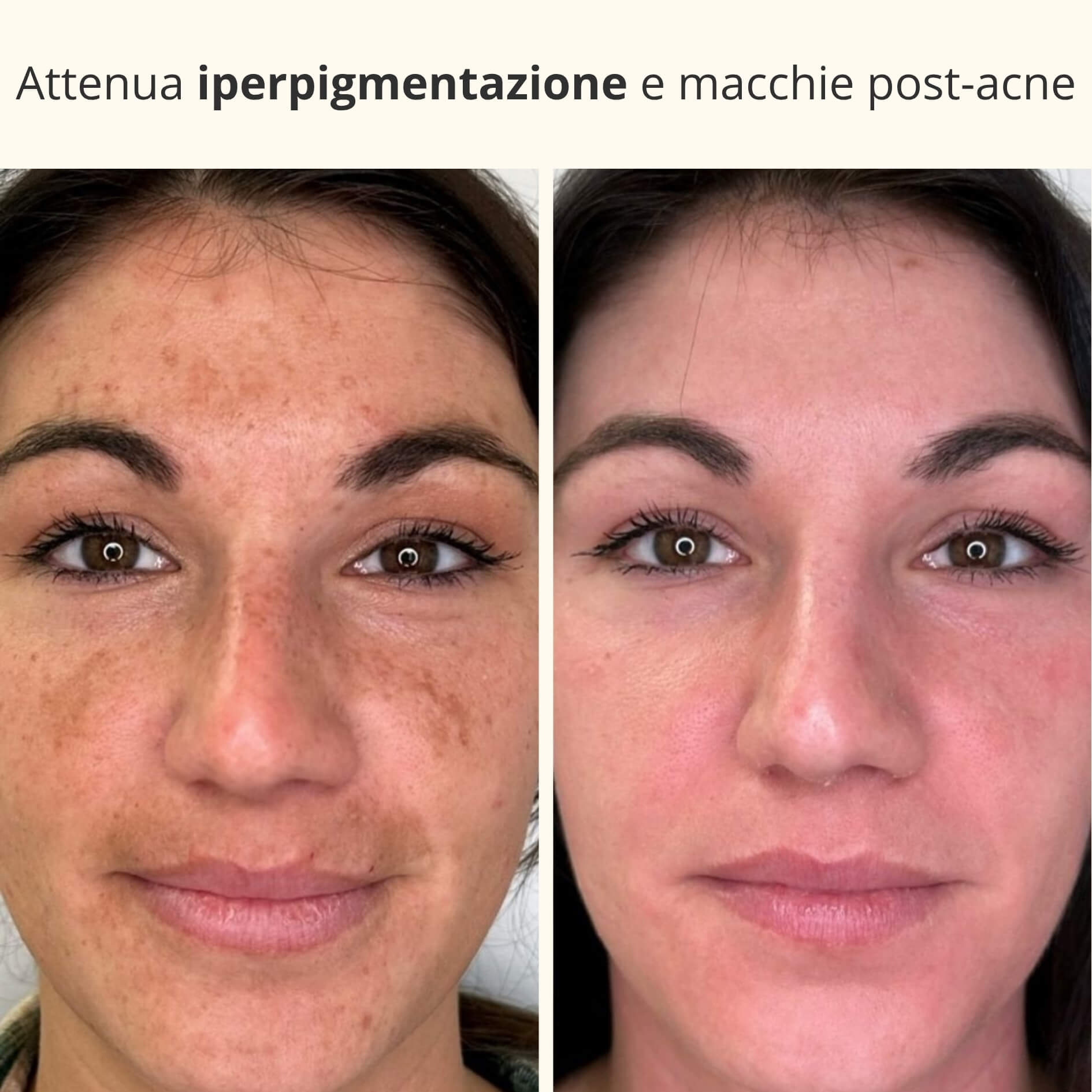 Maschera Notturna 3-in-1 con Acido Kojico e Curcuma
