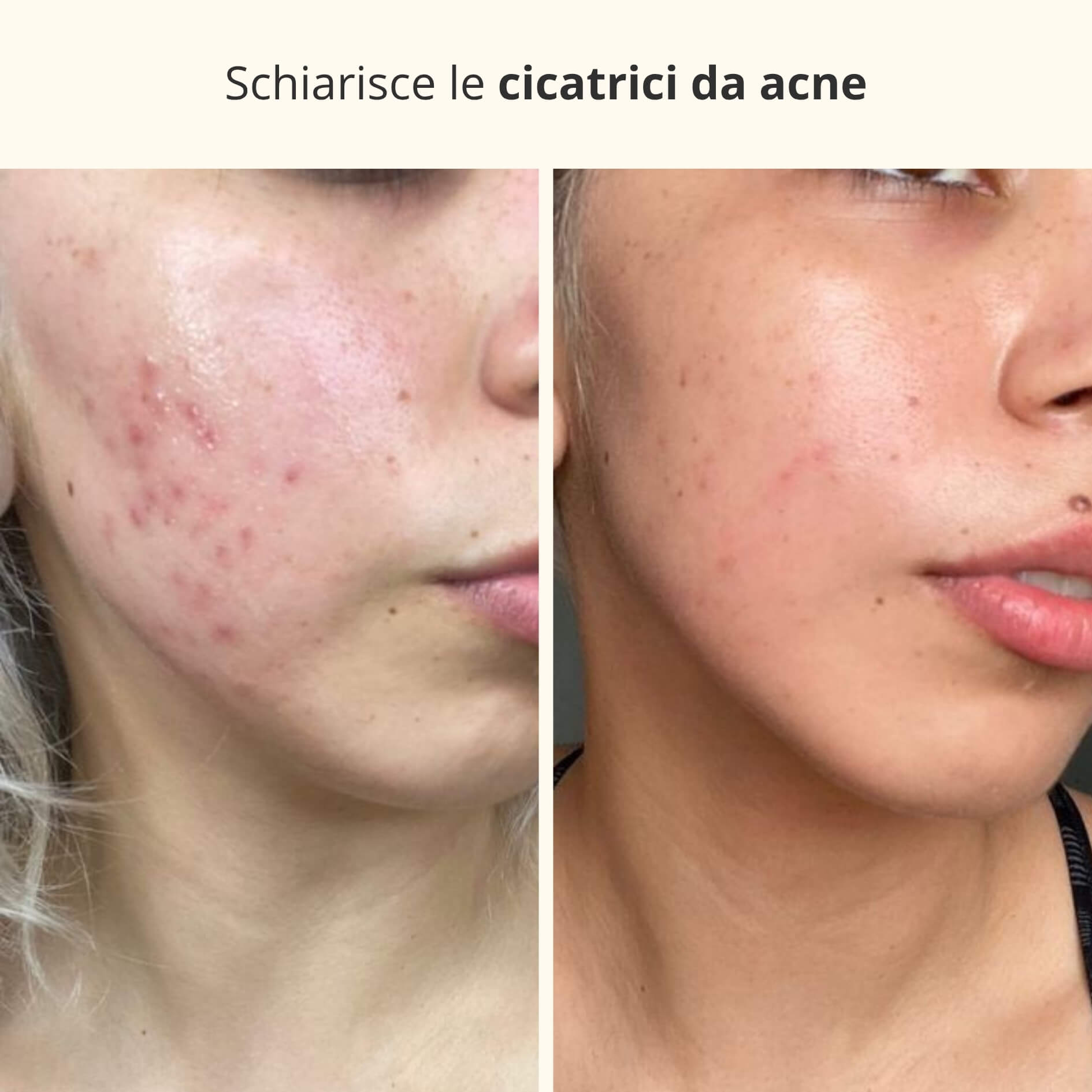 Maschera Notturna 3-in-1 con Acido Kojico e Curcuma