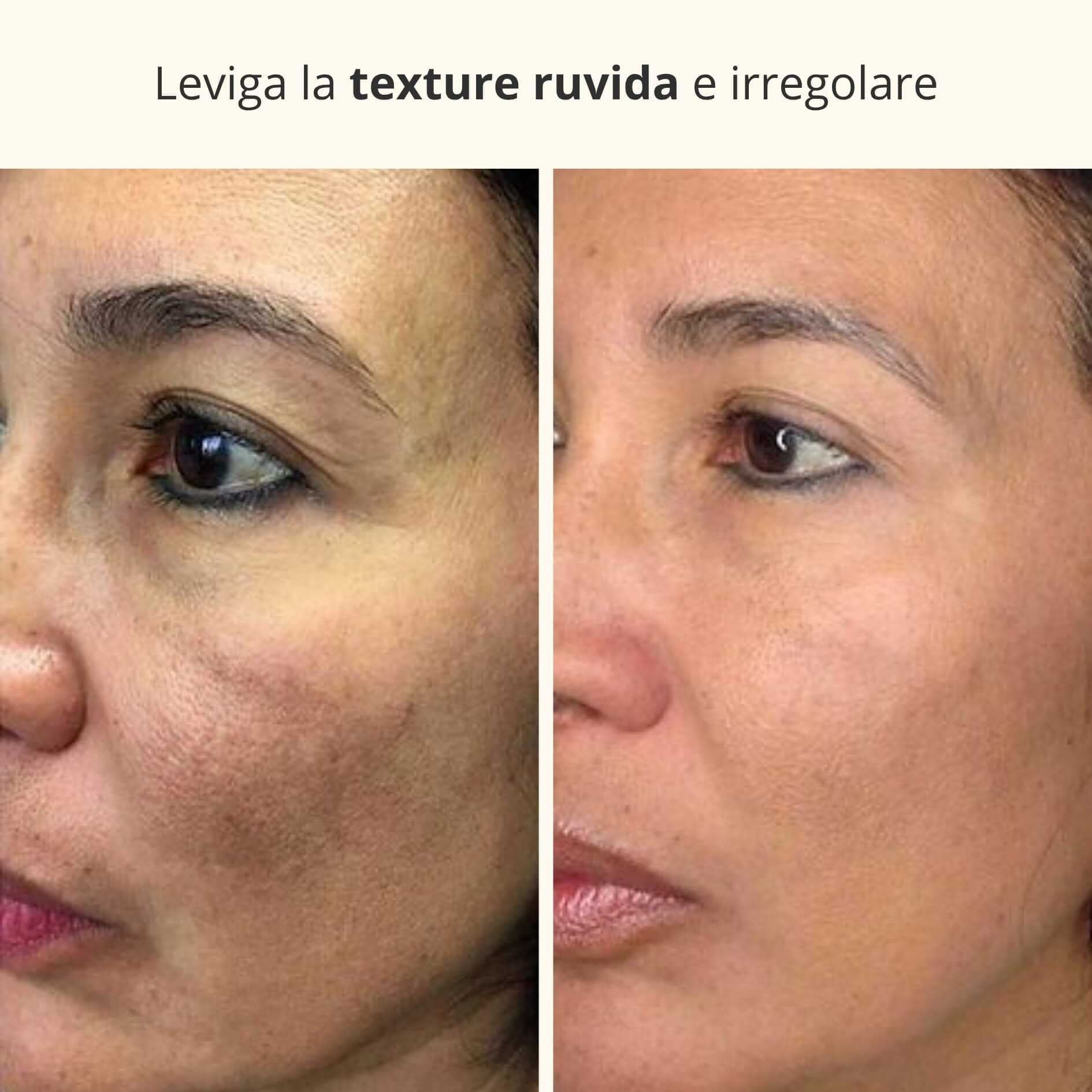 Maschera Notturna 3-in-1 con Acido Kojico e Curcuma