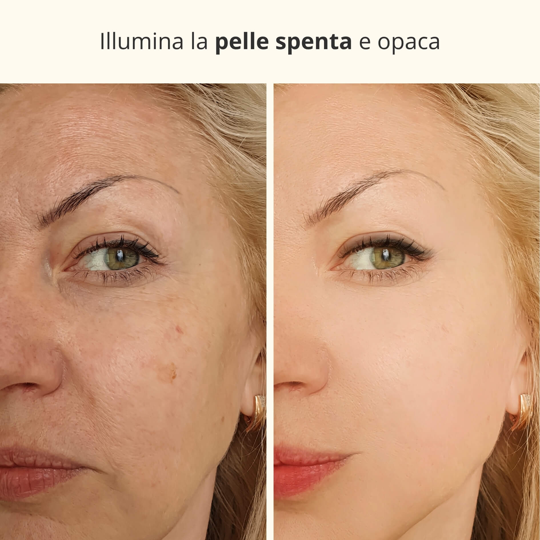 Maschera Notturna 3-in-1 con Acido Kojico e Curcuma