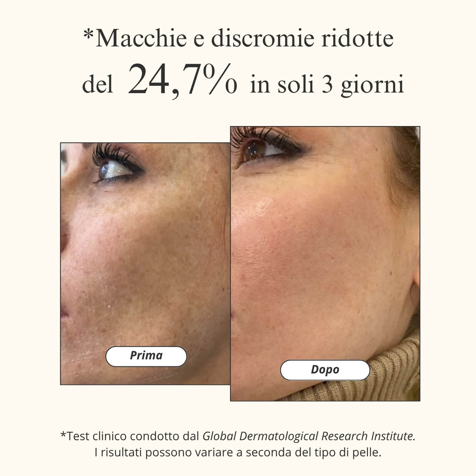 Maschera Notturna 3-in-1 con Acido Kojico e Curcuma