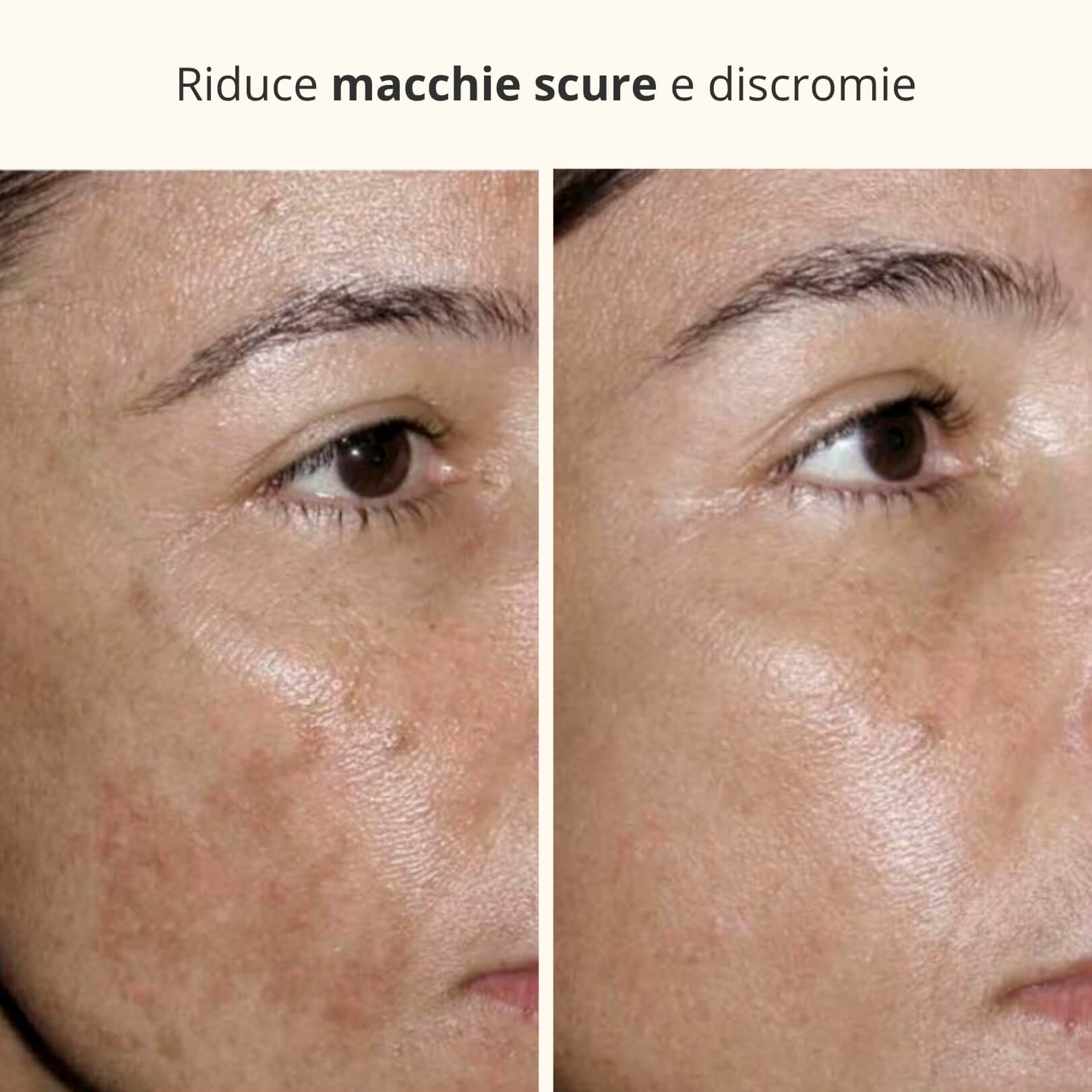 Maschera Notturna 3-in-1 con Acido Kojico e Curcuma