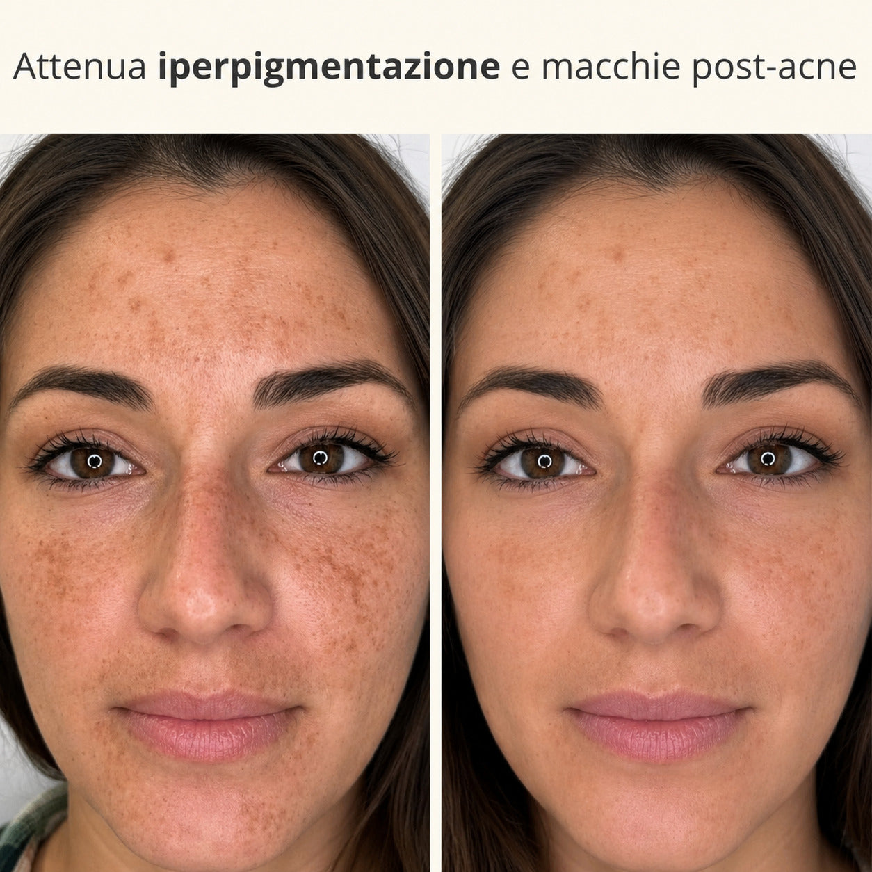 Maschera Notturna alla Curcuma e Acido Kojico